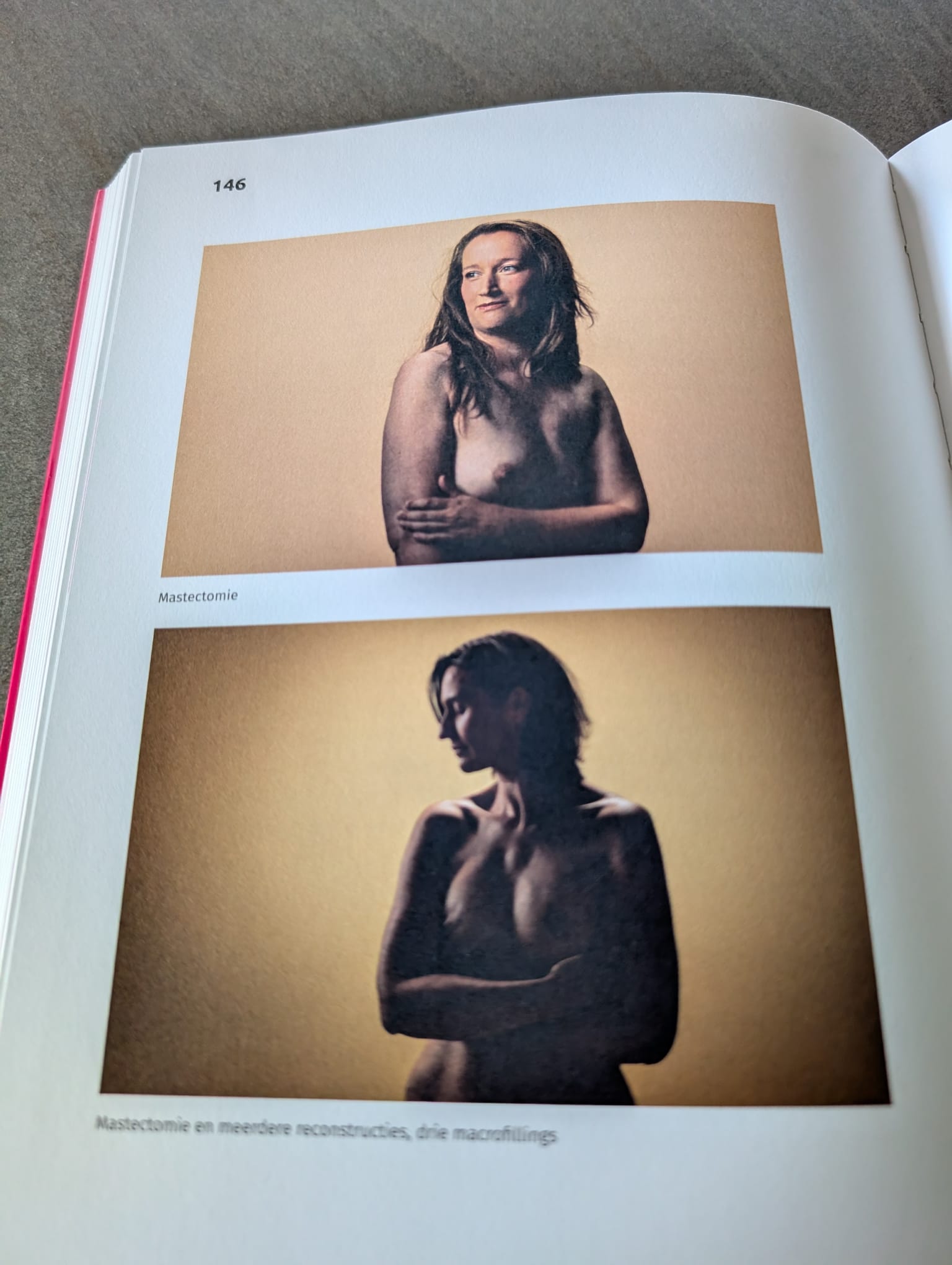 first chat with a breast nurse