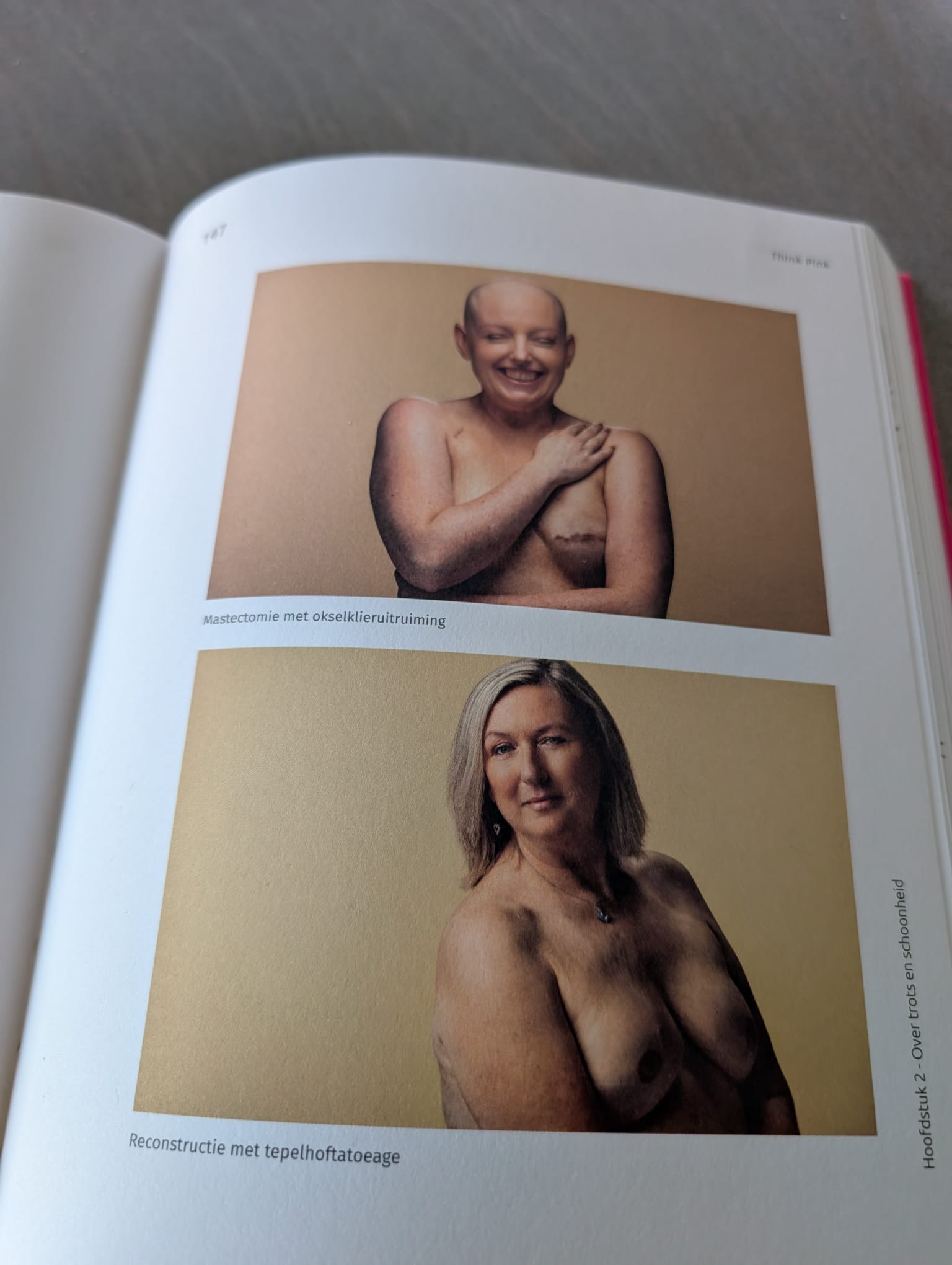 first chat with a breast nurse