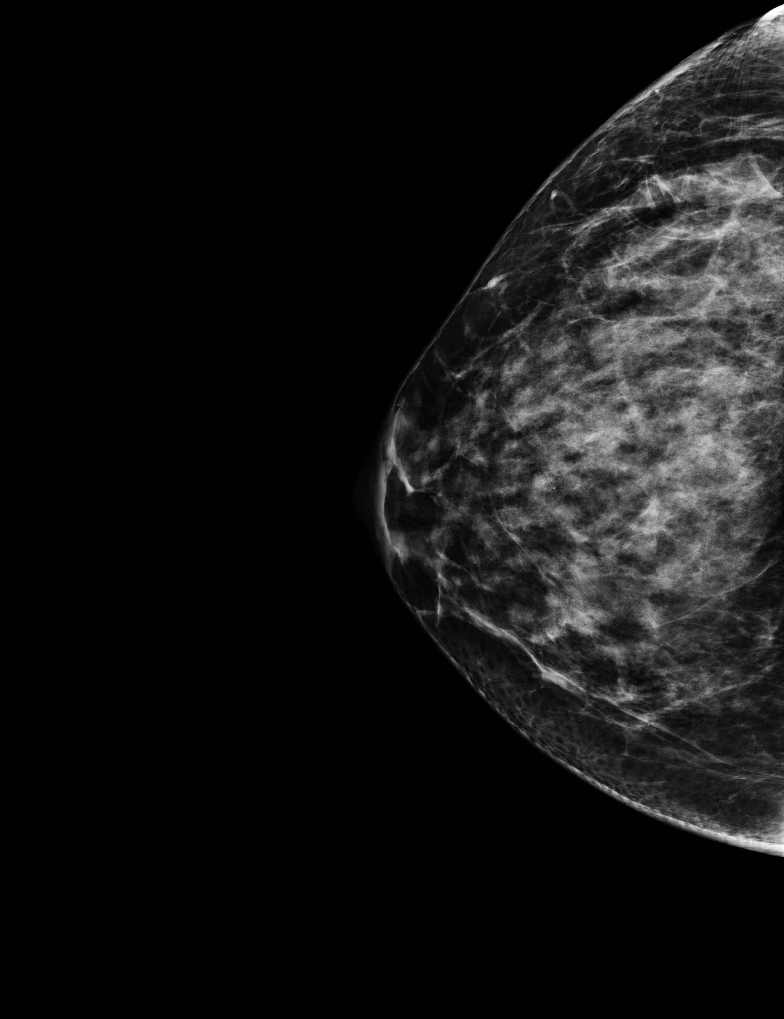 mammography, first visit with gynecologist: I was diagnosed