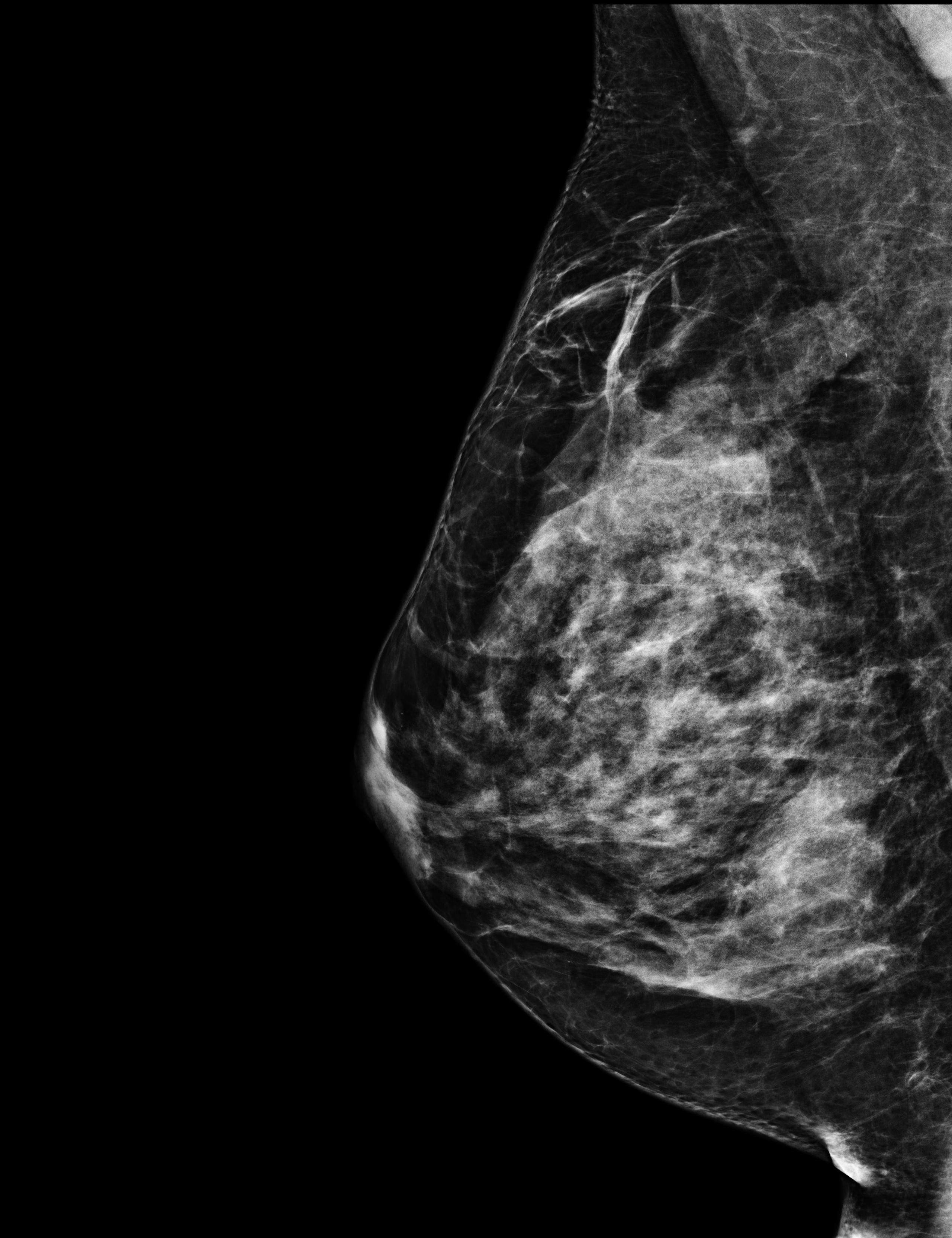 mammography, first visit with gynecologist: I was diagnosed