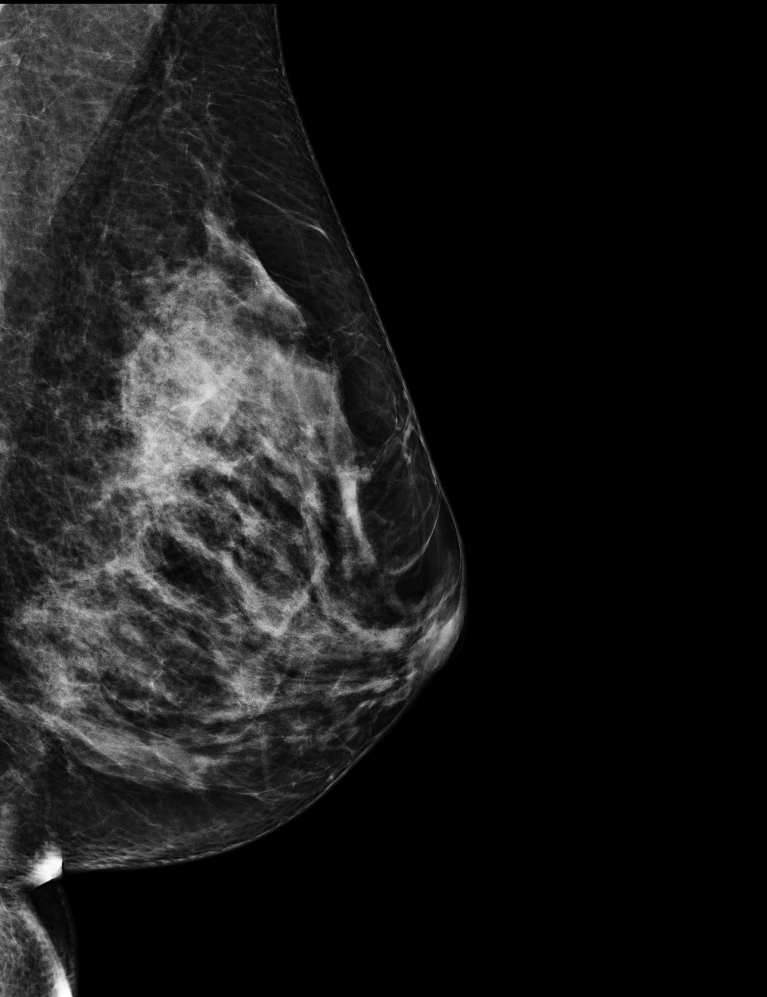 mammography, first visit with gynecologist: I was diagnosed