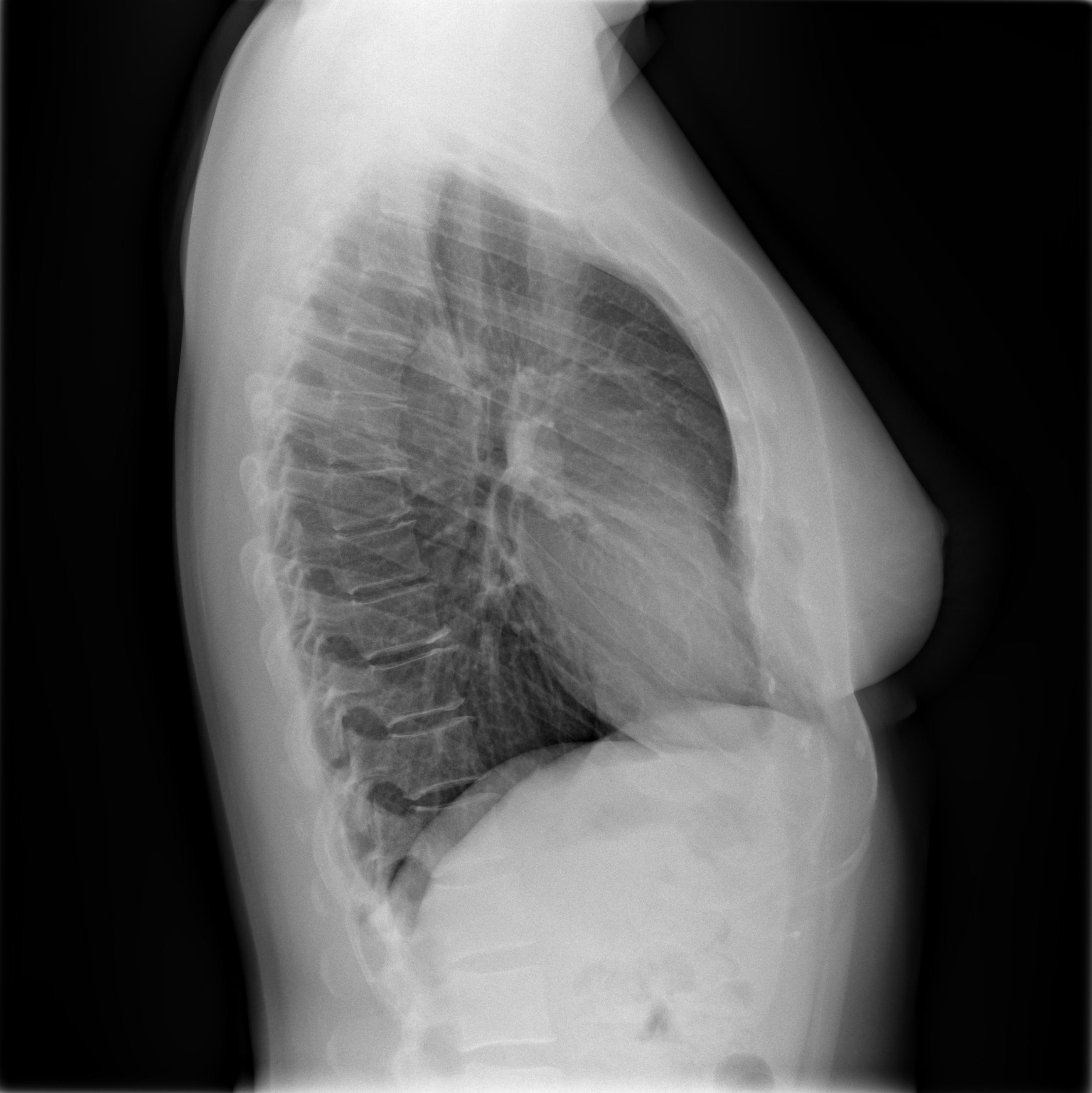 chest x-ray