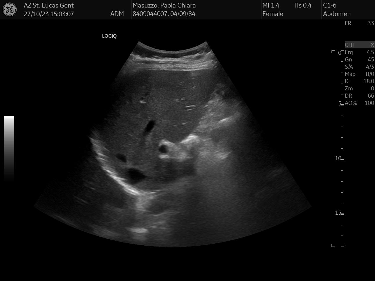 ultrasound liver, gallbladder, bile duct