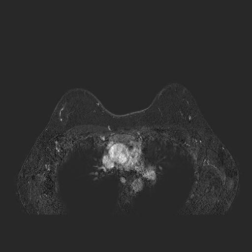 first magnetic resonance