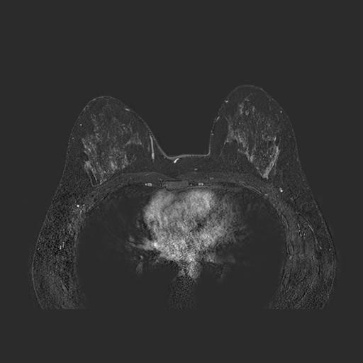 first magnetic resonance