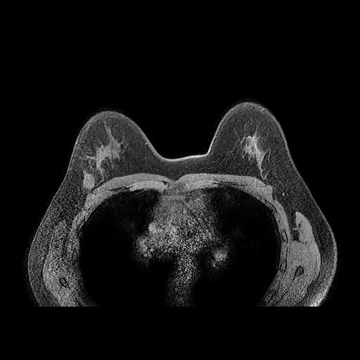 first magnetic resonance