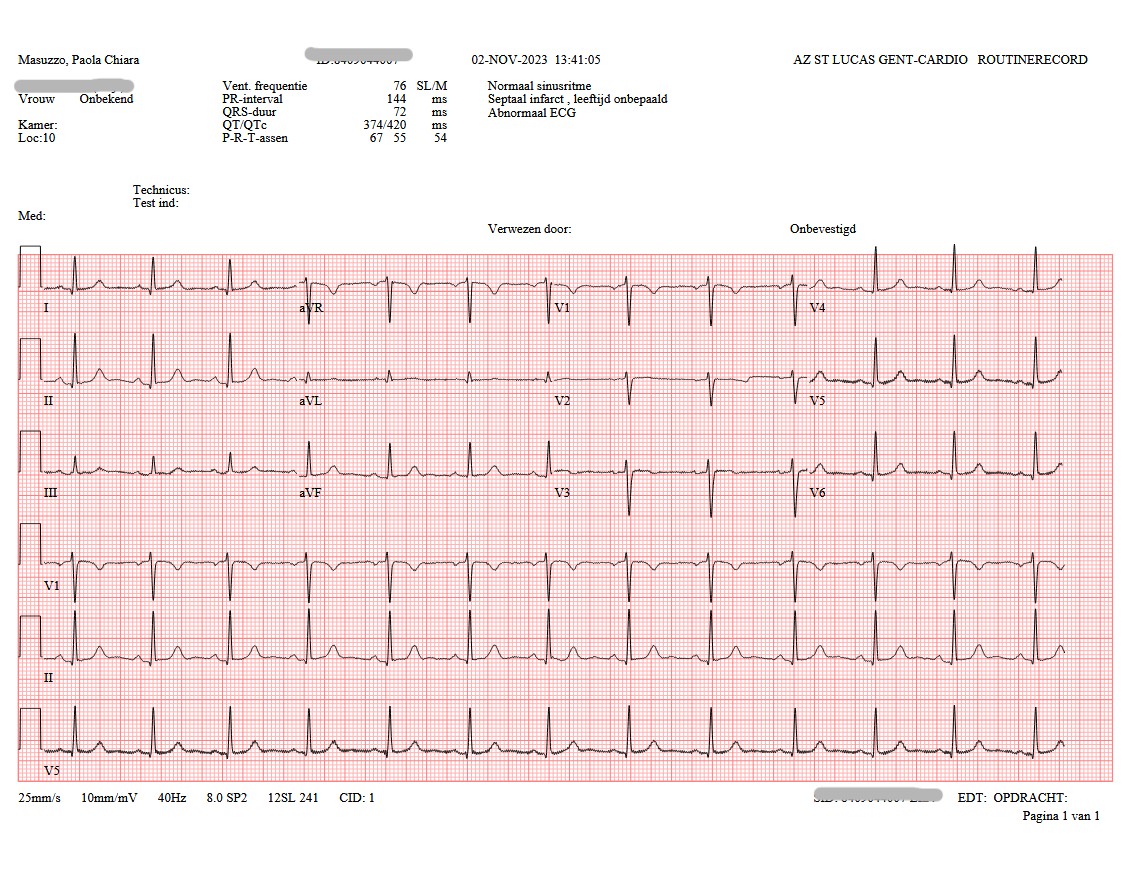 cardiological check in preparation of chemotherapy