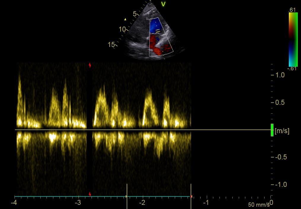 cardiological check in preparation of chemotherapy