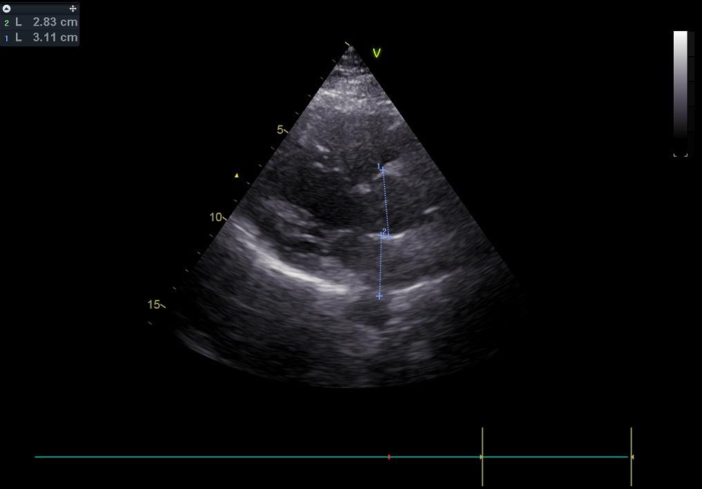 cardiological check in preparation of chemotherapy
